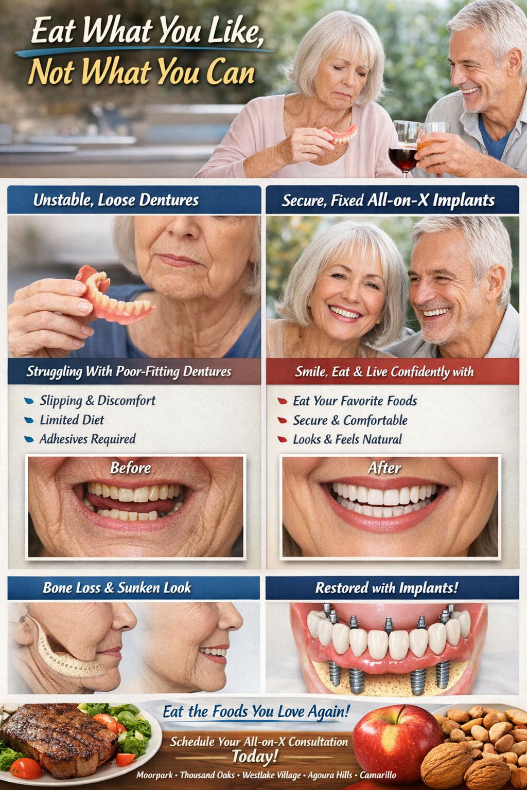 All-on-X Full Arch Implants in Moorpark CA